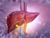 Sensor Can Detect Scarred or Fatty Liver Tissue to Help Prevent Liver Failure