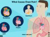 What Are the Causes of Chest Pain?