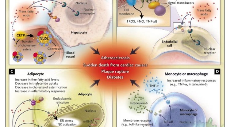 Trans fats and cardiovascular health: What is the current situation?