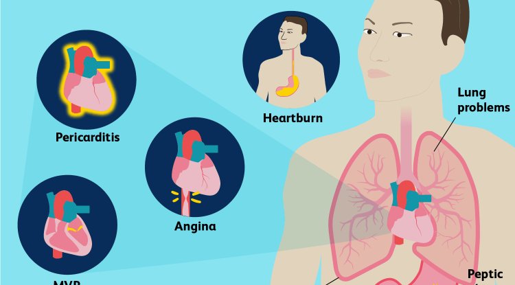 What Are the Causes of Chest Pain?