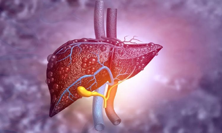 Sensor Can Detect Scarred or Fatty Liver Tissue to Help Prevent Liver Failure