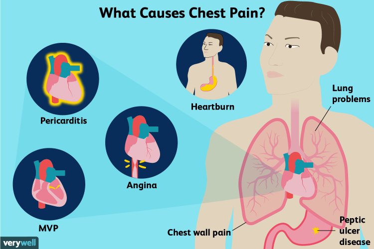 What Are the Causes of Chest Pain?
